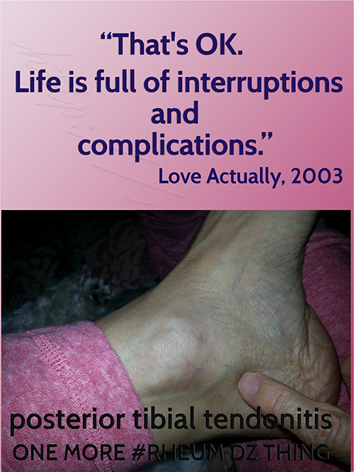 swollen-ankle-interruption-quote