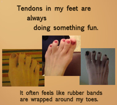pulling foot tendons