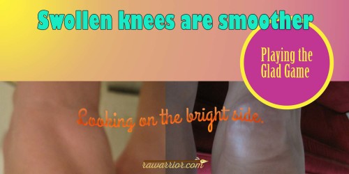 swollen knees are smoother