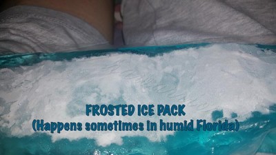 frosted over ice pack